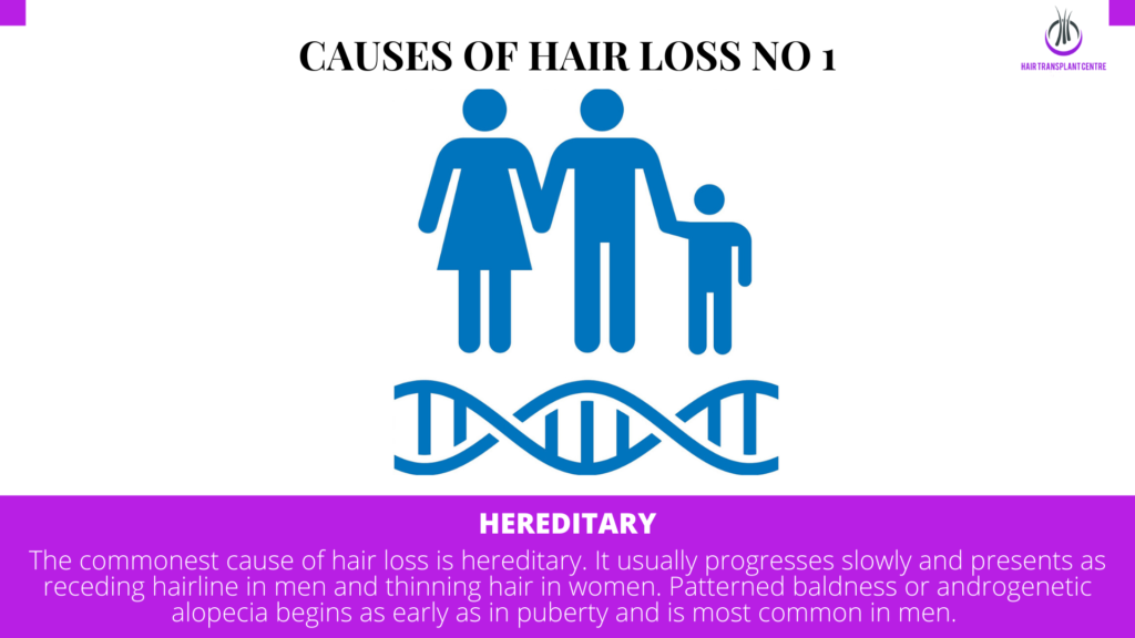 hereditary is hair loss factor